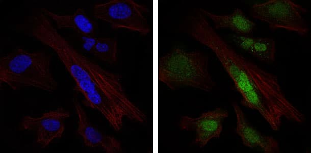 SOX9 Antibody (clone 1B11)