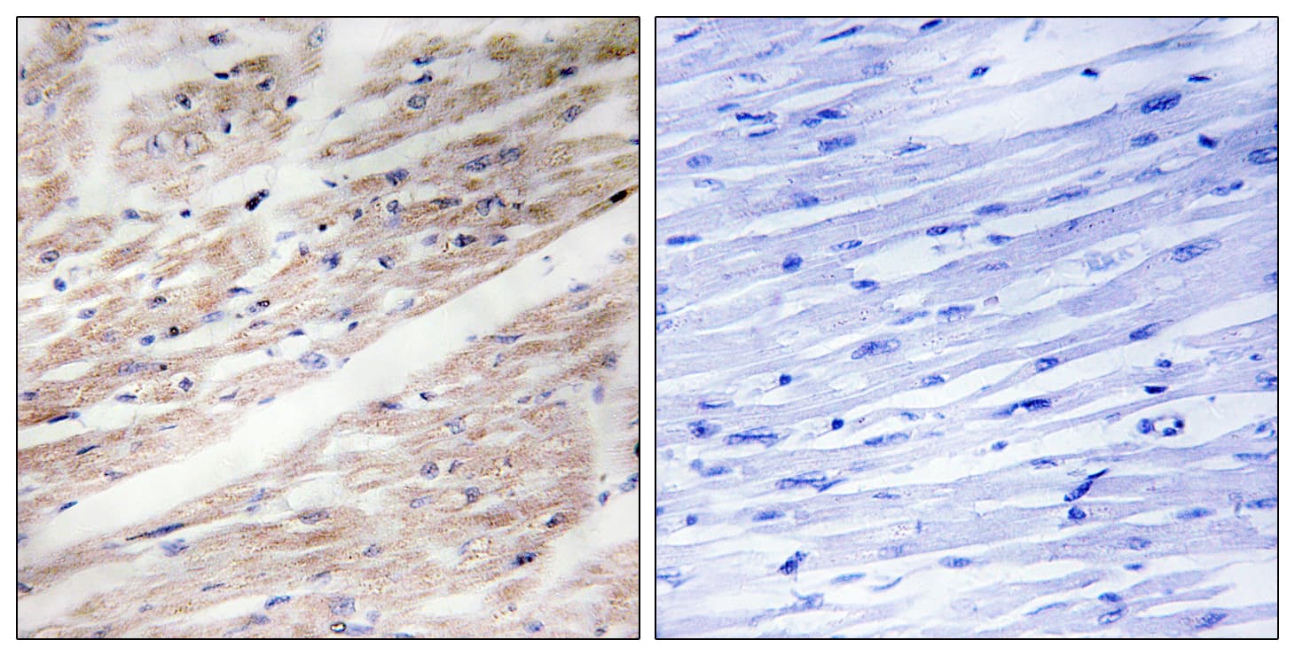 Polyclonal Rabbit anti-Human c-Kit / CD117 Antibody (phospho-Tyr936, IHC, WB)