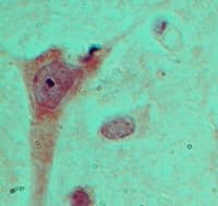 Polyclonal Rabbit anti-Human OLIG2 Antibody (aa70-120, IHC)
