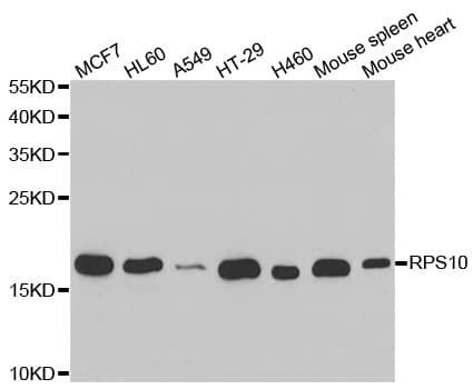 RPS10 / Ribosomal Protein S10 Antibody