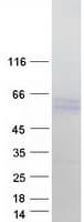 Human NCAPH2 / CAP-H2 Protein (Recombinant Myc-DDK (Flag))