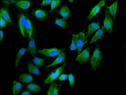 Polyclonal Rabbit anti-Human Dystonin / BPAG1 Antibody (IF)