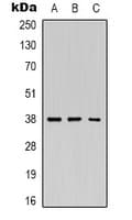 REN / Renin 1 Antibody (Internal)