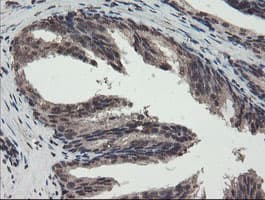 TDO2 Antibody (clone OTI2A4)