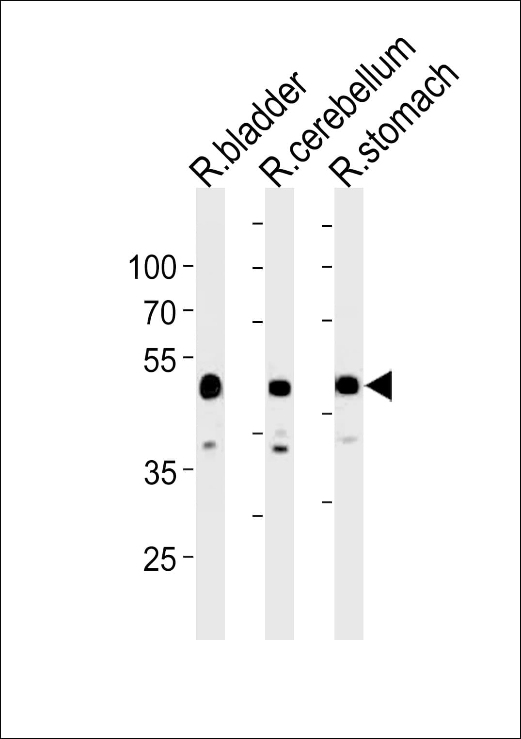 CBWD1 Antibody (aa325-351)