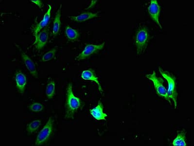 QPCTL Antibody (aa212-382)