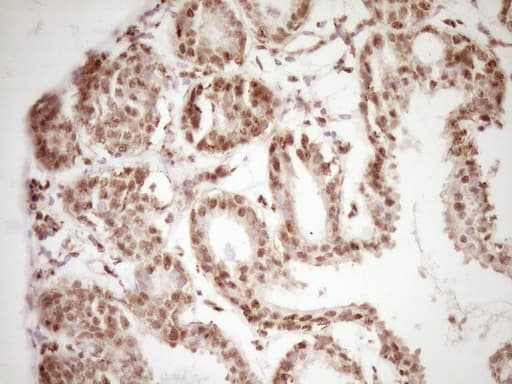 LPIN1 / Lipin 1 Antibody (clone OTI8F10)