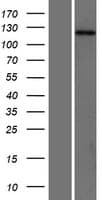 SH3PXD2A / TKS5 Protein (Over-Expression Lysate Myc-DDK (Flag))
