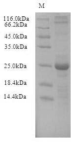 Human REXO4 / MPMC2 Protein (Recombinant 6His-B2M, N-terminus)
