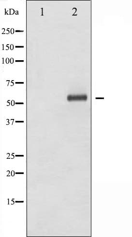 ELK1 Antibody (phospho-Ser383)