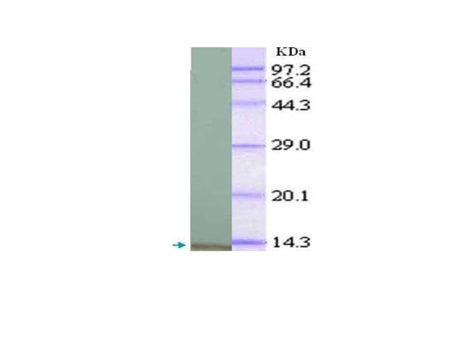 CXCL1 / GRO Alpha Antibody (aa36-107)