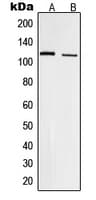 FAK / Focal Adhesion Kinase Antibody (phospho-Tyr861)