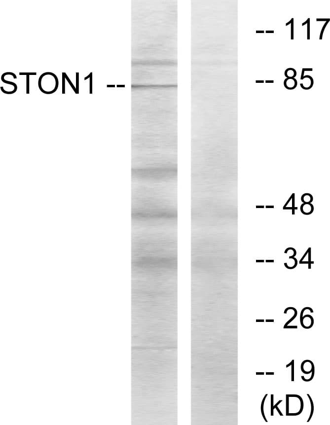 Polyclonal Rabbit anti-Human STON1 Antibody (aa686-735, WB)