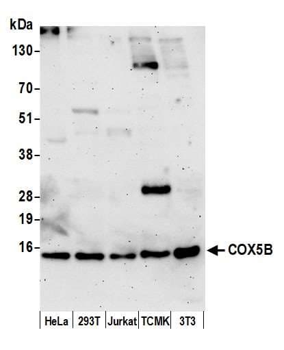 COX5B Antibody (aa25-75)