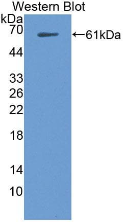 TPK1 Antibody (aa34-300, PE)