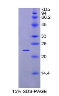 Mouse GAA / Alpha-Glucosidase, Acid Protein (Recombinant His, N-terminus)