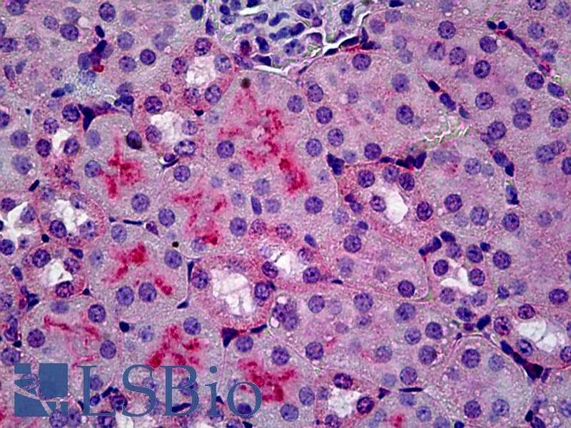 IHC-plus™ C5AR1 / CD88 / C5a Receptor Antibody (clone 10/92)