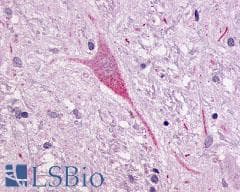PathPlus™ Polyclonal Rabbit anti-Human NTSR1 / NTR Antibody (N-Terminus, IHC)