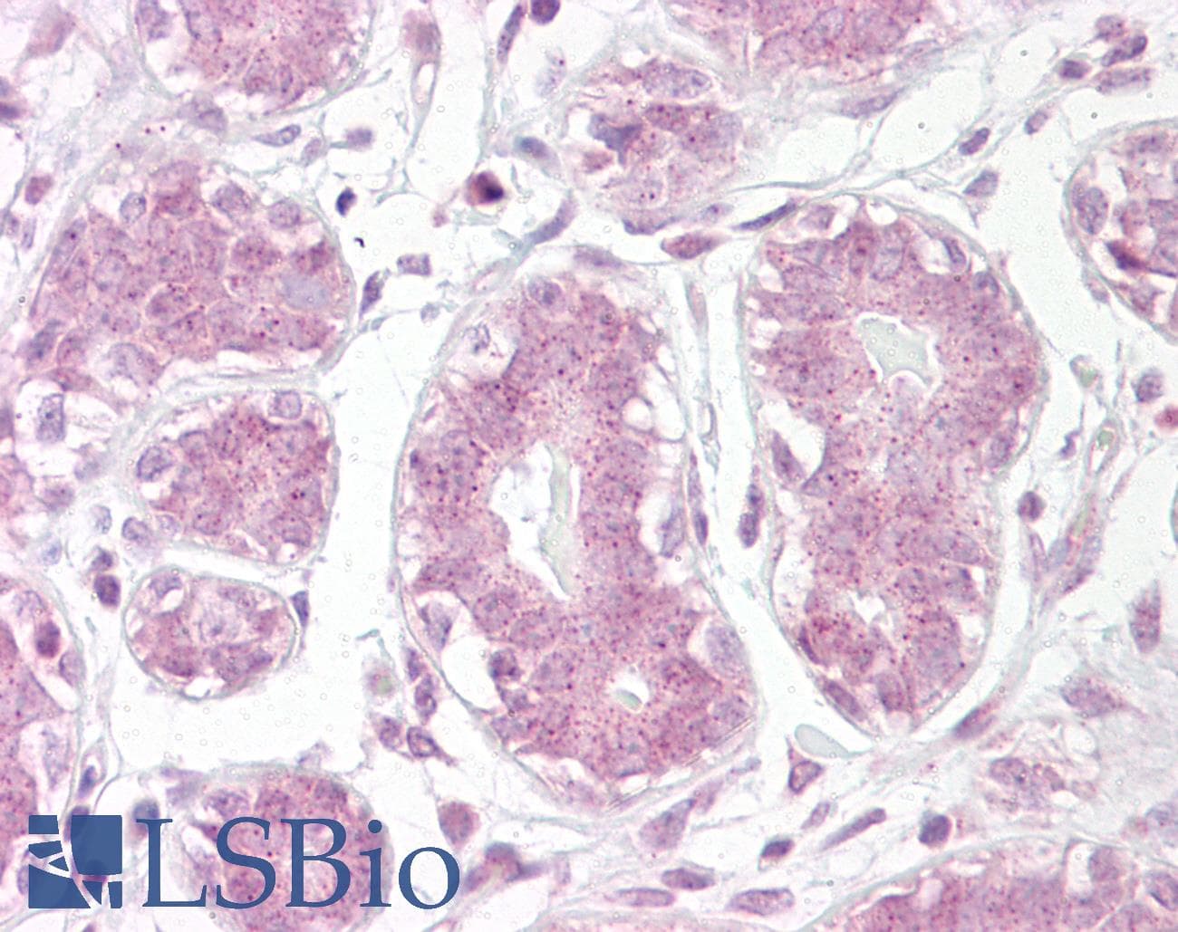 IHC-plus™ NFKBIA / IKB Alpha / IKBA Antibody (aa34-48)