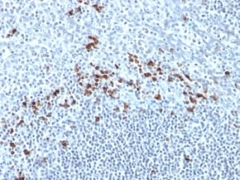 Mouse Anti-Human Kappa Light Chain Secondary Antibody (clone Kap-56, Ready-to-Use)