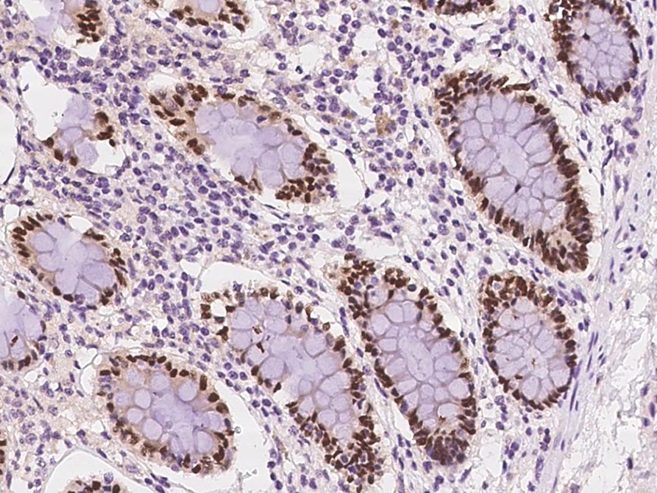 CDX1 Antibody