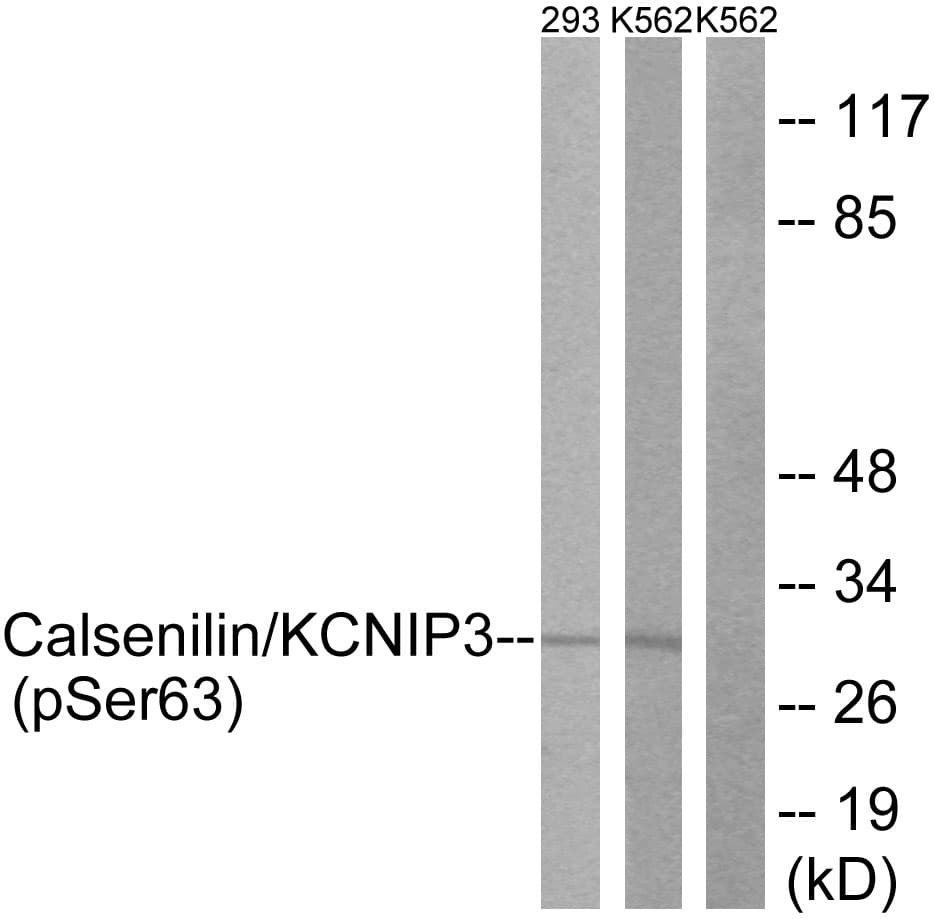 KCNIP3 / Dream / Calsenilin Antibody (phospho-Ser63)