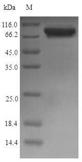 Escherichia coli glcB Protein (Recombinant 6His, N-terminus)