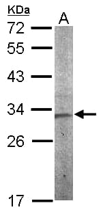 Polyclonal Rabbit anti-Human Vps60 / CHMP5 Antibody (aa1-202, IHC, WB)