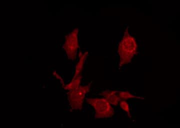 Polyclonal Rabbit anti-Human TWIK1 / KCNK1 Antibody (IF, WB)