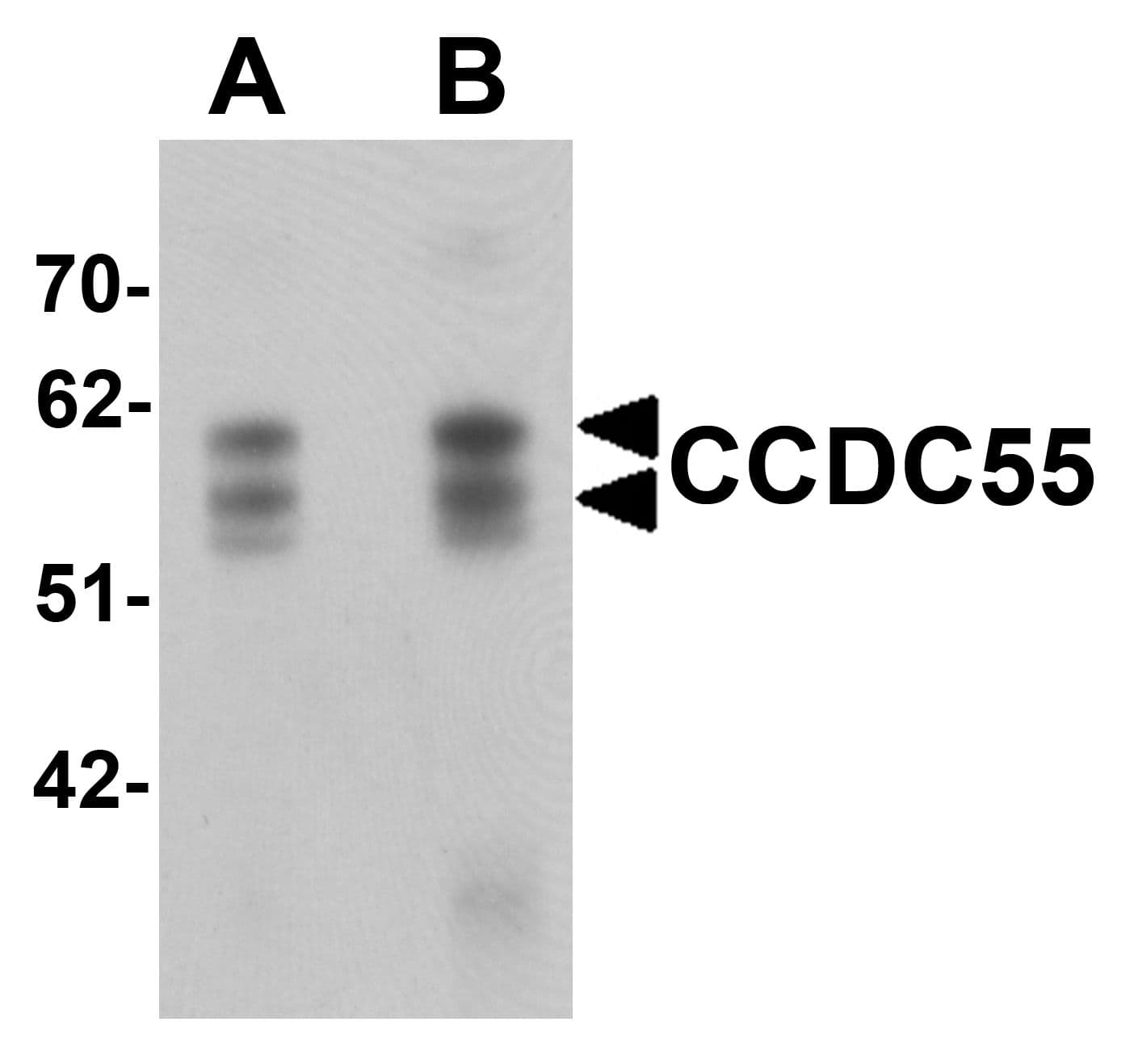 Polyclonal Chicken anti-Human CCDC55 Antibody (IF, WB)