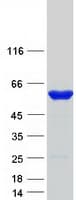 Human PFKFB1 Protein (Recombinant Myc-DDK (Flag))