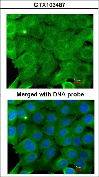 Polyclonal Rabbit anti-Human PRKAA2 / AMPK Alpha 2 Antibody (aa29-510, IHC, WB)