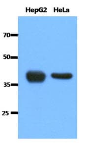 IHC-plus™ ACAT1 Antibody (clone AT2C5)