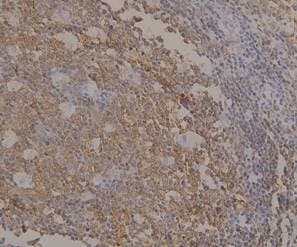 CD20 Antibody (aa210-297)