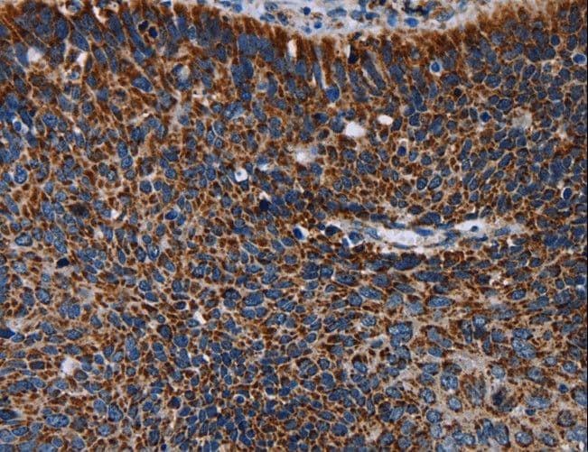 IDH2 Antibody