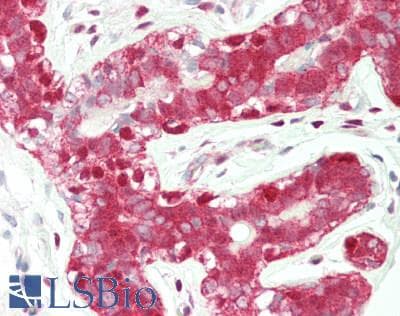 IHC-plus™ Polyclonal Rabbit anti-Human ADH5 Antibody (aa212-239, IHC, WB)