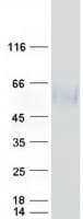 Human DNAM-1 / CD226 Protein (Recombinant Myc-DDK (Flag))