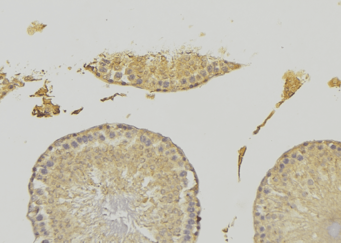 Testilin / EHD1 Antibody