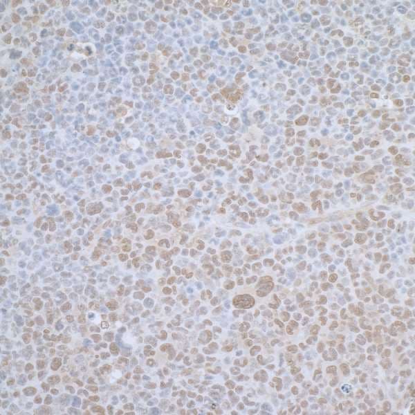 TCEB1 / Elongin C Antibody (aa1-50)