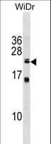 Polyclonal Rabbit anti-Human ISCU Antibody (aa138-167, WB)