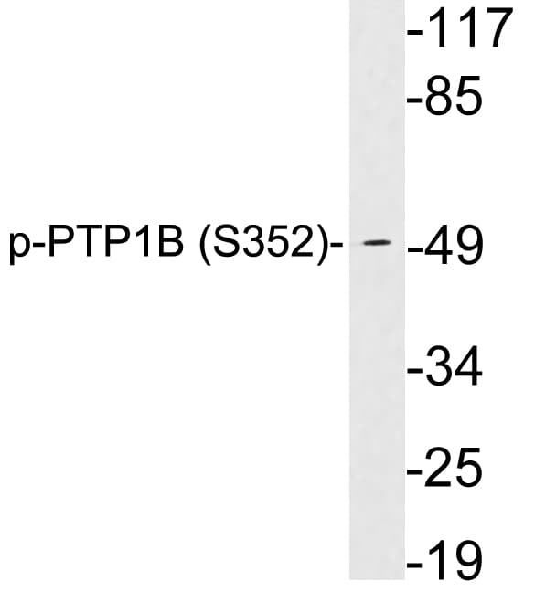 PTP1B Antibody (phospho-Ser352)