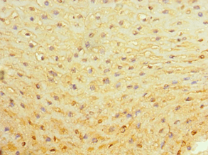 Polyclonal Rabbit anti-Human ALAS2 Antibody (aa50-320, IHC, WB)