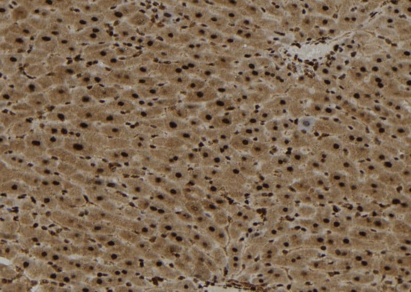 YTHDF2 Antibody