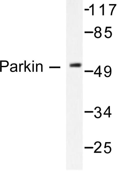 PARK2 / Parkin 2 Antibody (Gly12)