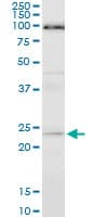 Monoclonal Mouse anti-Human APG5 / ATG5 Antibody (clone 1E7, WB)