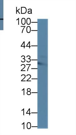 MTAP Antibody (aa6-275, PE)