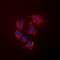 Polyclonal Rabbit anti-Human COL4A5 / Collagen IV Alpha5 Antibody (N-Terminus, IHC, IF, WB)
