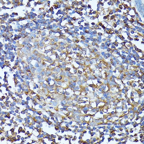 Polyclonal Rabbit anti-Human CXCR1 Antibody (IHC, WB)
