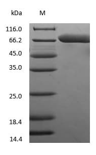 ALB / Serum Albumin Protein (Native)