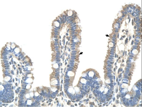 CLDN18 / Claudin 18 Antibody (C-Terminus, HRP)